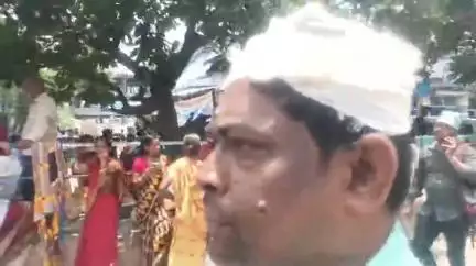 বহরমপুর: চোয়া এলাকায় বাইক দুর্ঘটনায় আহত এক ব্যক্তি, চিকিৎসার জন্য আনা হয় বহরমপুরMMC হাসপাতালে