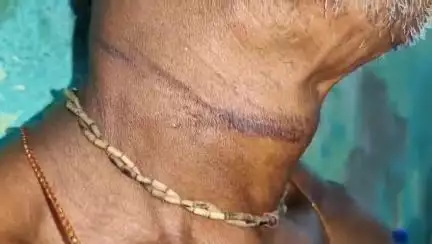 ক্যানিং ১: ছোটো মোল্লাখালি থানা এলাকার তরুণীকে ধর্ষণের অভিযোগ, অপমানে হাসপাতালের বাথরুমে আত্মহত্যার চেষ্টা অভিযুক্তের