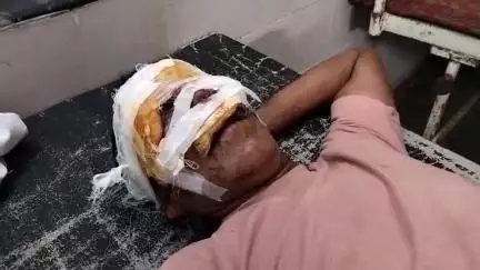 मिहोना: गोपालपुरा स्टेट हाइवे पर अज्ञात वाहन ने बाइक को मारी टक्कर, बाइक पर सवार दो लोग घायल