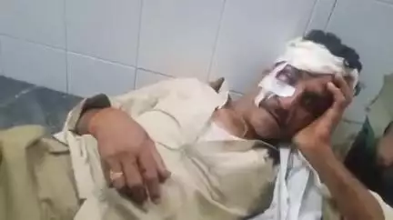 अशोक नगर: नई कृषि उपज मंडी गेट के पास ट्रक से बचने में फिसली बाइक, 45 वर्षीय व्यक्ति घायल