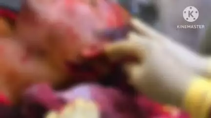 नवागढ़: बिलारी गांव में जमीन विवाद के दौरान चाकू और डंडे से हमला, 1 व्यक्ति की मौत, दूसरा गंभीर घायल