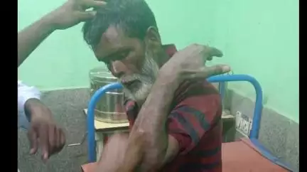 ডোমকল: হারুরপাড়া মাঠ এলাকায় বাইকের ধাক্কায় আহত হলো এক পথ পথচারী
