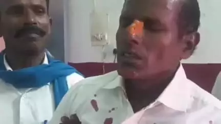 बिसवां: बिसवां बहराइच मार्ग पर रसूलपुर गांव के पास ब्रेकर से टकराकर अनियंत्रित हुई बाइक, सड़क पर पलटने से दो लोग हुए घायल