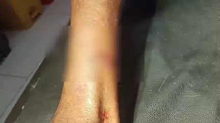 മാനന്തവാടി: എൽ.എഫ് സ്കൂളിന് സമീപം വയോധികന് തെരുവുനായയുടെ ആക്രമണത്തിൽ പരിക്ക്