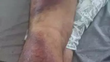 आबू रोड: आबूरोड के डेरना गांव में शराब ठेकेदार के साथ बाइक सवार की खुलेआम मारपीट, 3 लोगों ने लाठी से किया वार