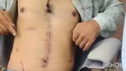 उज्जैन शहर: करोहन में गरीब परिवार का आरोप, केस दर्ज होने के बाद भी पुलिस ने आरोपी को गिरफ्तार नहीं किया