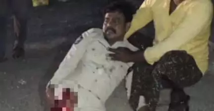 తాడికొండ: జిల్లాలోని మేడికొండూరులో ఘోర రోడ్డు ప్రమాదం.. అనిల్ అనే కానిస్టేబుల్ కు తీవ్ర గాయాలు, తెగిపడిన కాలు