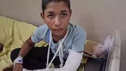 लाडपुरा: कापरेन थाना इलाके के बालापुरा गांव में पेड़ पर चढ़कर जामुन खाने वाले बालक को गिरने पर हुआ घायल, MBS अस्पताल में भर्ती