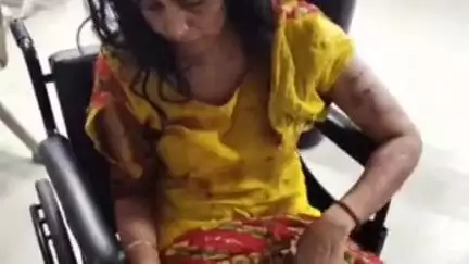 हिसार: हिसार के भैणी अमीरपुर में पत्नी को दांतों से काटा, सास ने ज्योत जलाने बुलाया तो बेटी को बालों से घसीटा