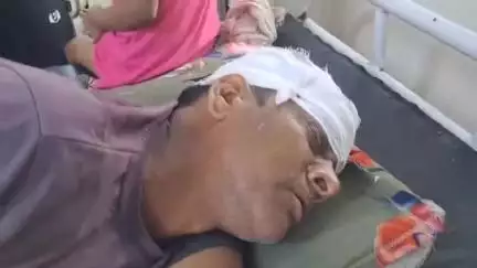 भिंड नगर: पुरानी बस्ती में करंट लगने से अधेड़ की हालत बिगड़ी