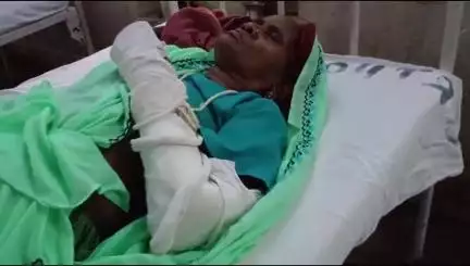 बांसवाड़ा: एमजी अस्पताल में 39 दिन बाद भी नहीं हुआ 65 वर्षीय कड़वी का ऑपरेशन, टूटा हाथ दर्द से लाचार