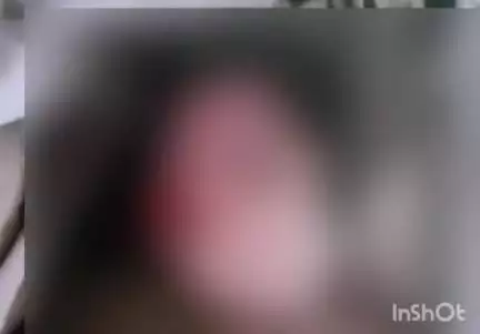 उरई: ग्राम जेसारीकला में घर पर सो रही महिला को जहरीले सांप ने कांटा, इलाज के दौरान हुई महिला की मौत