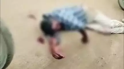 రెండు మోటార్ సైకిల్ ఢీకొని వ్యక్తికి తీవ్ర గాయాలు, గోపాలపురంలో ఘటన