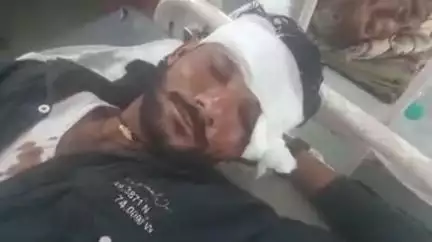 बारां: इसलामपुरा पटपडी गांव में जमीन विवाद के चलते एक युवक के साथ लकड़ियों से की गई मारपीट, जिला अस्पताल में कराया भर्ती