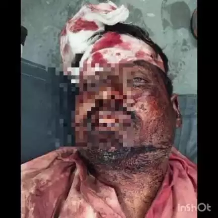 తాండూరు: భూత తగాద లో ఓ వ్యక్తి మృతి: కేసు నమోదు చేసి దర్యాప్తు చేస్తున్న పోలీసులు