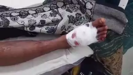 शहपुरा: करही घाट में सड़क हादसे में बाइक सवार युवक हुआ घायल, शहपुरा अस्पताल में इलाज जारी