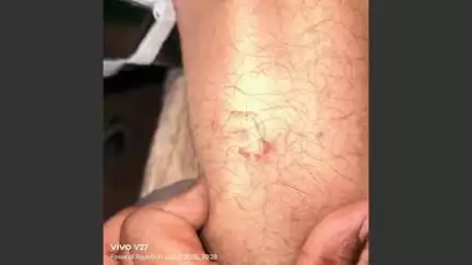 खण्डार: खंडार सावलपुर में बंदरों के आतंक से ग्रामीण परेशान, लोग जानलेवा हमलों के शिकार बन रहे हैं