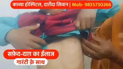 औरैया: सिवान जिले के काव्या हॉस्पिटल में सफेद दाग का गारंटी के साथ हो रहा है इलाज, दवा का असर नहीं तो पैसा वापस | 9835730266