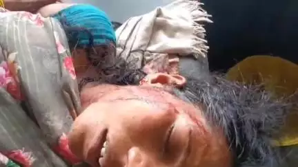 सूरजगढ़: खावा चंद्रटोला में मारपीट, दो महिलाओं समेत तीन घायल, सूरजगढ़ा के अस्पताल में इलाज जारी