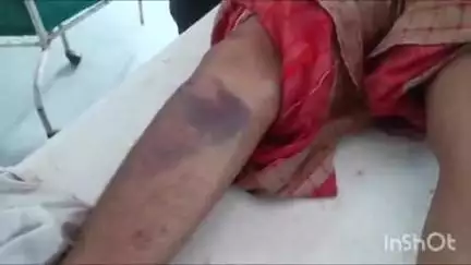 कोल: तारापुर में देवरानी और जेठानी के बीच ब्रा (बनियान) का झगड़ा थाने पहुंचा, जेठानी ने देवरानी पर मारपीट का आरोप लगाया