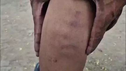 अलीगंज: गढ़िया अहिरान में बंटवारे की आग में भाईचारे की मर्यादा झुलसी, भाई और भतीजे ने एक व्यक्ति को पीटा
