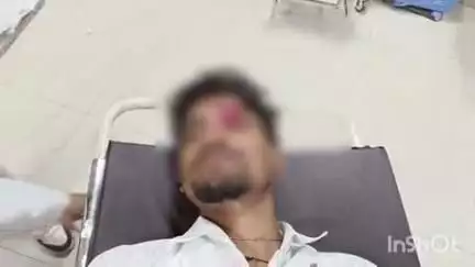 कायमगंज: नवाबगंज रोड पर बरौन के पास नीलगाय से टकराकर तेज रफ्तार बाइक सवार युवक घायल, अस्पताल में इलाज जारी