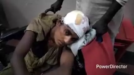 कटिहार: लक्ष्मीपुर में भूमि विवाद में दो पक्षों के बीच मारपीट, महिला जख्मी