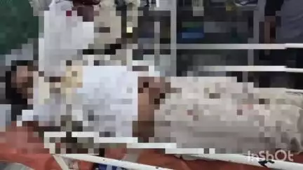 दुर्ग: बीएसपी के रेल मिल में फायर कर्मी के हाथ पर फटा फायर एक्सटिंग्विशर, सेक्टर 9 अस्पताल में इलाज जारी