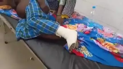 खड्डा: हरपुर मझार में खेत में काम करते समय रसल वाइपर सांप ने किसान को डसा, जिला अस्पताल में हुआ इलाज