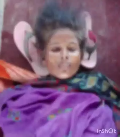 వరంగల్ రైల్వే స్టేషన్‌లో అనారోగ్యంతో మృతి చెందిన మహిళ, MGM మార్చురీలో భద్రపరిచిన రైల్వే పోలీసులు