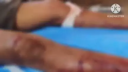 मिरज: नांद्रे मध्ये अपघातात वृद्ध गंभीर जखमी;एकावर सांगली ग्रामीण पोलिसात गुन्हा दाखल
