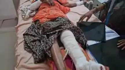 पीपलदा: सुमेर नगर की झोपड़ियों में घर के बाहर चबूतरे पर बैठी महिलाओं को कार ने रौंदा, 4 घायल MBS अस्पताल में भर्ती