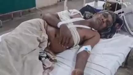 बागीदौरा: कलिंजरा रोड पर दो बाइकों की भिड़ंत में 45 वर्षीय व्यक्ति को लगी गंभीर चोट, एमजी अस्पताल में किया गया रेफर