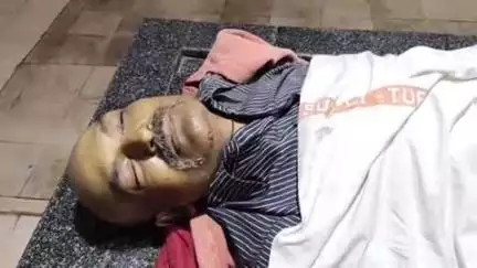 అనంతపురం నగరంలోని ప్రభుత్వ సర్వజన ఆస్పత్రిలో కదిరిలో ఆర్టీసీ బస్సు ఢీకొన్న సంఘటనలో గాయపడిన వ్యక్తి చికిత్స పొందుతూ మృతి