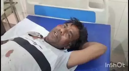 बरेली: मणिनाथ पुलिया पर अनियंत्रित ऑटो पलटने से चालक हुआ घायल, इलाज जारी