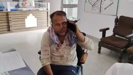 राजगढ़: मिठड़ी बलवंतसिंह में खेत की सींव तोड़ने के विवाद पर एक व्यक्ति पर धारदार कुल्हाड़ी, गंडासी, फावड़ा व जेली से हमले का आरोप
