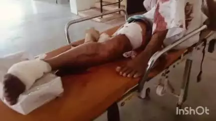 नेपानगर: डवाली नेपानगर फाटे पर भीषण सड़क हादसे में युवक गंभीर घायल, एंबुलेंस तक नहीं मिली!