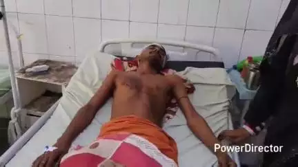 मऊ: रैपुरा के इटवा गांव निवासी युवक ने भाइयों पर मारपीट कर कुएं में फेंकने का आरोप लगाया, घायल जिला अस्पताल में भर्ती