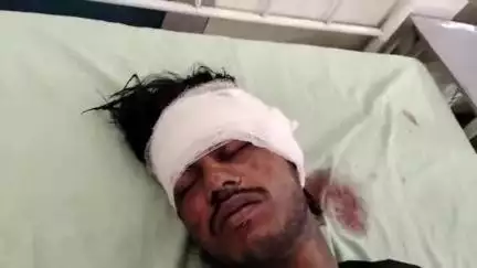 मुरादाबाद: जीरो प्वाइंट पर ट्रक ने बाइक में मारी टक्कर, बाइक सवार युवक गिरकर हुआ घायल
