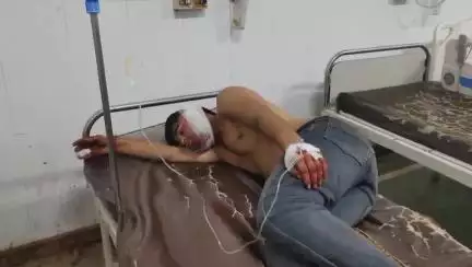 तिर्वा: सिकरोरी गांव के सामने दो पक्षों में जमकर हुई मारपीट, 3 घायल, ट्रक और कार में टक्कर को लेकर हुआ विवाद