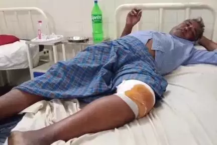 పుంగనూరు: రోడ్డుపై కుక్క అడ్డం రావడం వల్ల ద్విచక్ర వాహనం బోల్తా పడి ఒకరికి గాయాలు.