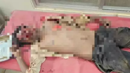 गुण्डरदेही: गुण्डरदेही के नदियापारा आंगनबाड़ी क्रमांक 2 के पास अज्ञात कार चालक ने बाइक सवार दो युवकों को मारी ठोकर, मामला दर्ज