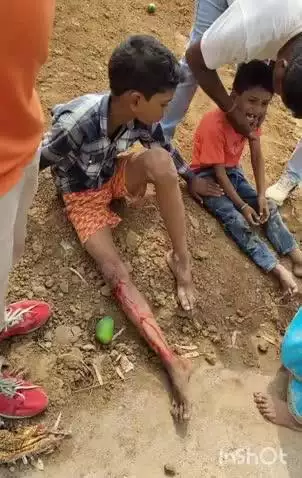 कांडी: कांडी थाना मुख्यालय के रामलखन पेट्रोल पंप के पास कार और बाइक की टक्कर में दो बच्चे सहित तीन घायल