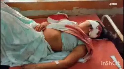 बांगरमऊ: मकबूल खेड़ा में दो बाइक की टक्कर, दंपति घायल, पत्नी को लखनऊ रेफर किया गया
