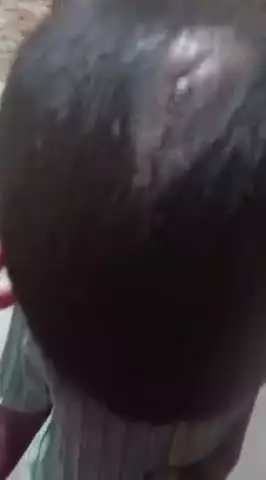 dalvir Nagar Panipat mein kutte Ne bacche ko kiya Gambhir Roop se Ghayal