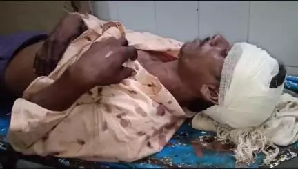 बांसवाड़ा: सोमपुर गांव में भैंस चोरी के मामले में दबंगों ने एक व्यक्ति के साथ की मारपीट, एमजी अस्पताल में उपचार जारी