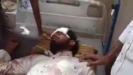 पीपलदा: इटावा खातोली मार्ग पर कार की टक्कर से मोटरसाइकिल सवार युवक गंभीर घायल, एमबीएस अस्पताल में भर्ती