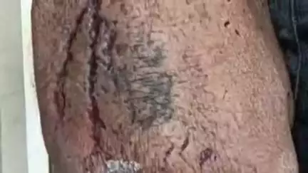 हिण्डौन: गढी पनवेडा गांव के पास सड़क हादसे में बाइक सवार की हुई मौत, सदर थाना पुलिस ने शव की शिनाख्त के लिए मोर्चरी में भेजा शव