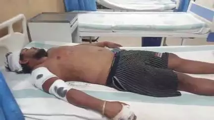 गोगरी: जमालपुर गोगरी 14न रोड मे दबंगों ने एक नीरा बेवसाई को गोली फायरिंग कर युवक को मारपीट कर किया घायल.