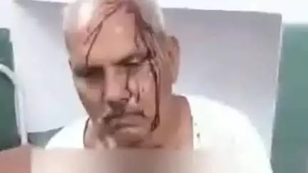 आंवला: आंवला में किसान और उसके बेटे पर हमला, खेत से लौटते समय लाठी-डंडों से पिटाई, पुलिस में की गई शिकायत